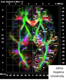 Image shows colored picture demonstrating orientations of fibers based on principle eigenvectors and eigenvalues of DTI matrices.