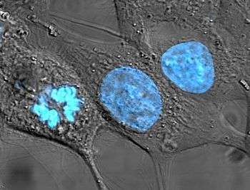 HeLa cells stained with Hoechst blue stain.