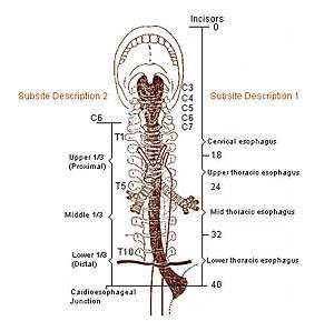 Diagram showing the four constrictions of the esophagus.