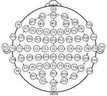 EEG 10-20 system with Modified Combinatorial Nomenclature