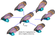 figure depicting multiple coordinate systems generated from MRI images and generating a common template coordinate system.