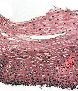 Histological section of the esophageal wall.