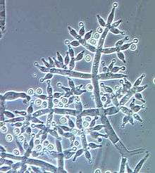 An aggregation of long, thin translucent cells that are multiply branched. Some of the terminal branches have a small circular cell at their tips.